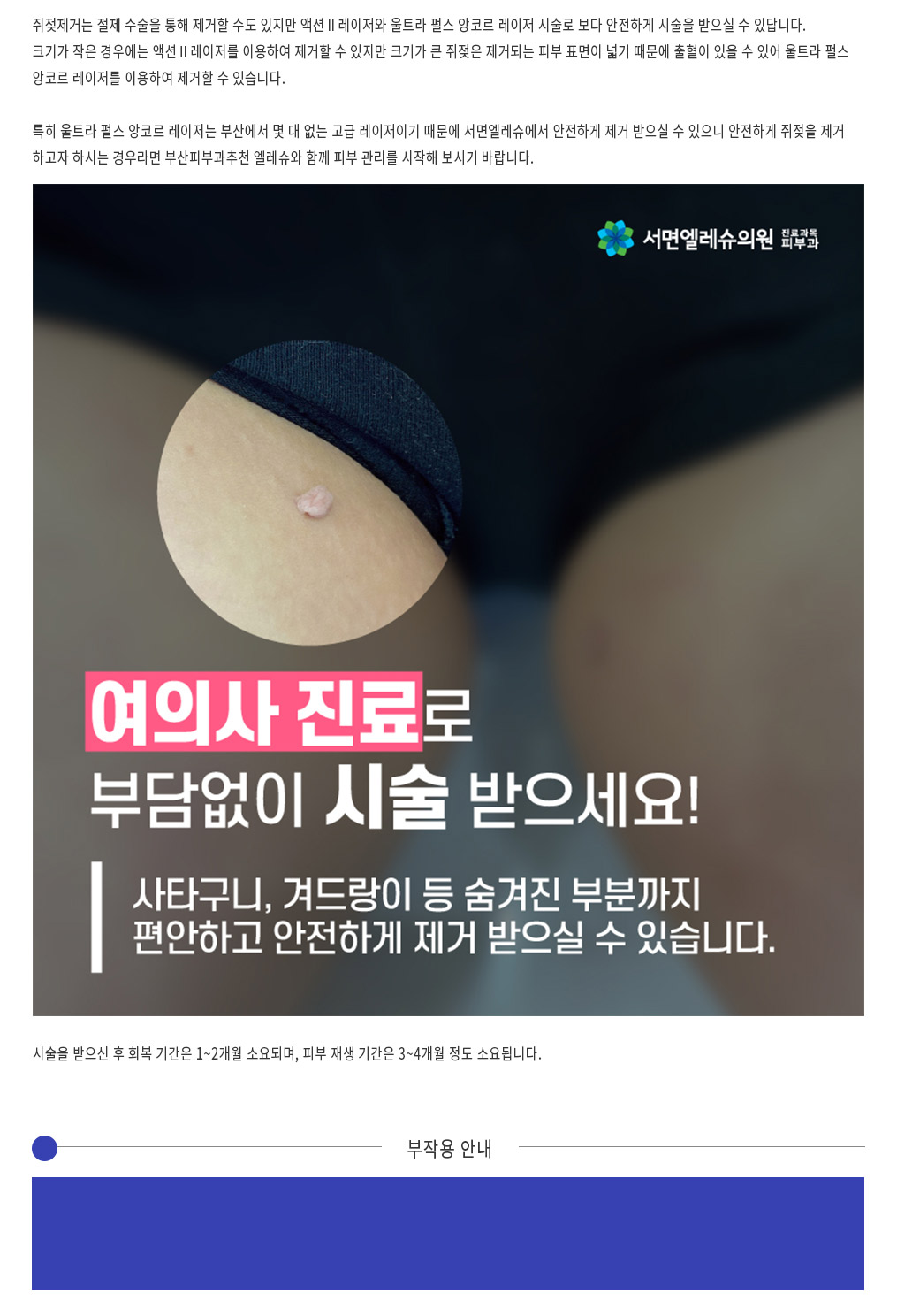 쥐젖
