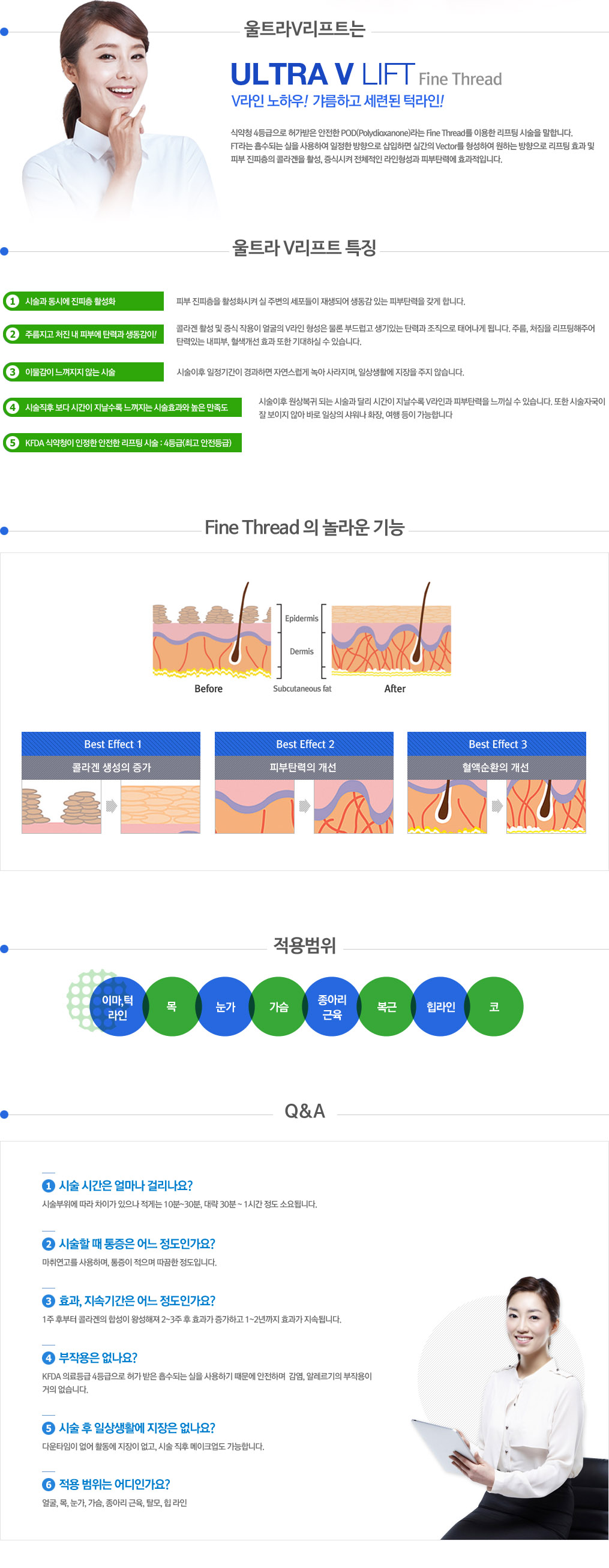 울트라v리프팅