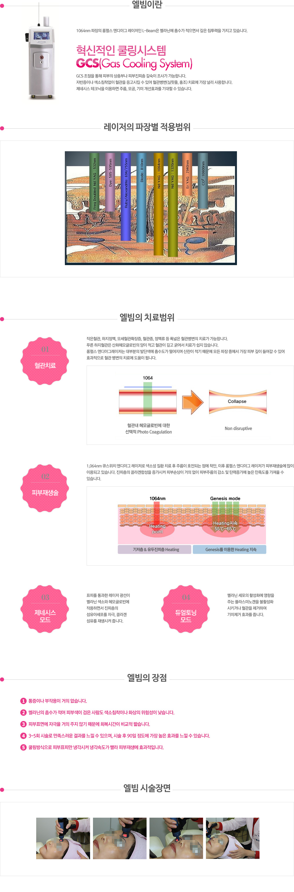 엘빔